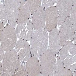 SENP7 Antibody, Novus Biologicals 25 &mu;L | Buy Online | Novus Biologicals | Fisher Scientific