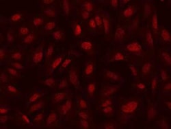 SEPHS2 Antibody, Novus Biologicals:Antibodies:Primary Antibodies