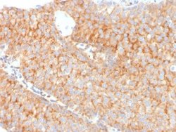 SERBP1 Antibody (SERBP1/3491) - Azide and BSA Free, Novus Biologicals 100 &mu;g | Buy Online | Novus Biologicals | Fisher Scientific
