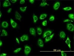 SERBP1 Antibody (1D2-2E9), Novus Biologicals 0.1 mg, Unconjugated:Antibodies,