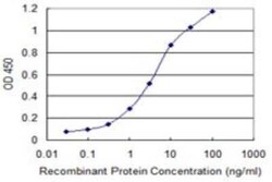 SERBP1 Antibody (1G5-2D7), Novus Biologicals 0.1 mg | Buy Online | Novus Biologicals | Fisher Scientific