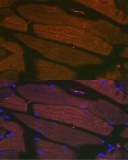 SERCA1 ATPase Rabbit anti-Human, Mouse, Rat, Clone: 2T8S3, Novus Biologicals