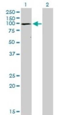 SERCA1 ATPase Antibody (1B11), Novus Biologicals 0.1 mg | Buy Online | Novus Biologicals | Fisher Scientific