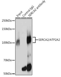 SERCA2 ATPase Rabbit anti-Human, Mouse, Rat, Clone: 10F0M9, Novus Biologicals 100 &mu;g | Buy Online | Novus Biologicals | Fisher Scientific