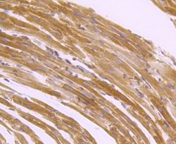 SERCA2ATPase Rabbit anti-Human, Clone: JM10-20, Novus Biologicals 100&mu;L:Antibodies,