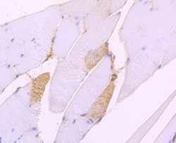SERCA2ATPase Rabbit anti-Human, Clone: JM10-20, Novus Biologicals 100&mu;L:Antibodies,