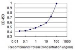 SERCA3 ATPase Antibody (1B9), Novus Biologicals 0.1 mg | Buy Online | Novus Biologicals | Fisher Scientific
