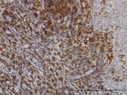 SERCA3 ATPase Antibody (2H3), Novus Biologicals 0.1 mg | Buy Online | Novus Biologicals | Fisher Scientific