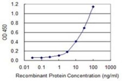 SERPINB1 Antibody (4D7), Novus Biologicals 0.1 mg | Buy Online | Novus Biologicals | Fisher Scientific