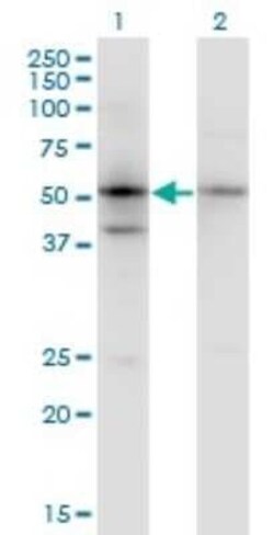 SERPINB1 Antibody (4D7), Novus Biologicals 0.1 mg | Buy Online | Novus Biologicals | Fisher Scientific
