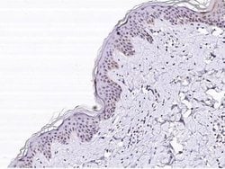 SERPINB4 Rabbit anti-Human, Clone: 1, Novus Biologicals 50 &mu;g; Unconjugated:Antibodies,