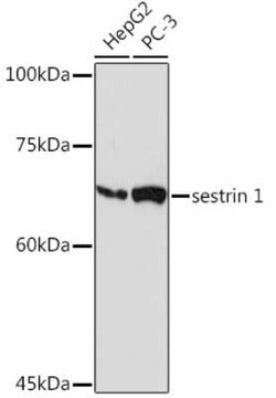 SESN1 Rabbit anti-Human, Mouse, Rat, Clone: 7I5Y4, Novus Biologicals 20
