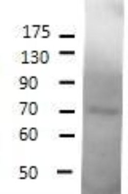 SESN1 Antibody, Novus Biologicals 0.025 mg; Unconjugated:Antibodies, Polyclonal