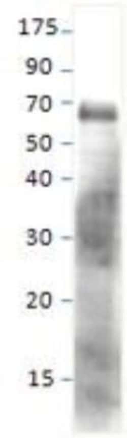 SESN1 Antibody, Novus Biologicals 0.025 mg; Unconjugated:Antibodies, Polyclonal