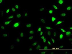SESN2 Antibody (3B8), Novus Biologicals 0.1 mg; Unconjugated:Antibodies,