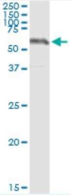SESN2 Antibody (3B8), Novus Biologicals 0.1 mg; Unconjugated:Antibodies,