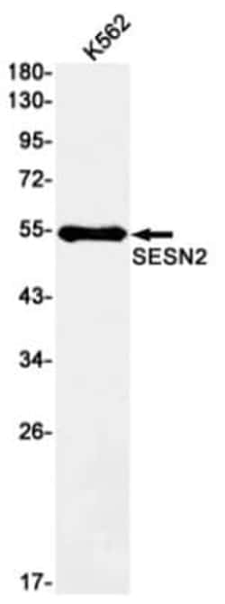 SESN2 Antibody (S05-8C1), Novus Biologicals:Antibodies:Primary Antibodies