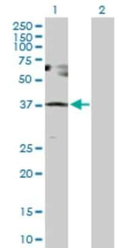 SESN3 Antibody, Novus Biologicals 0.1 mg | Buy Online | Novus Biologicals | Fisher Scientific
