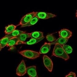 SET Mouse anti-Human, Clone: PCRP-SET-1C6, Novus Biologicals 20 &mu;g;