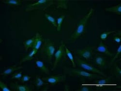 SETBP1 Antibody, Novus Biologicals 0.05 mg | Buy Online | Novus Biologicals | Fisher Scientific