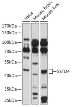 SETD4 Antibody - Azide and BSA Free, Novus Biologicals:Antibodies:Primary