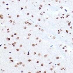 SETD5 Antibody - Azide and BSA Free, Novus Biologicals 0.1 mL | Buy Online | Novus Biologicals | Fisher Scientific
