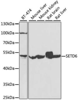 SETD6 Antibody - BSA Free, Novus Biologicals 0.1 mL, Unconjugated:Antibodies,