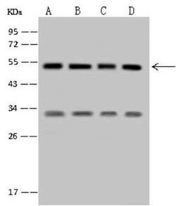 SETD8 Antibody, Novus Biologicals 100 &mu;g | Buy Online | Novus Biologicals | Fisher Scientific