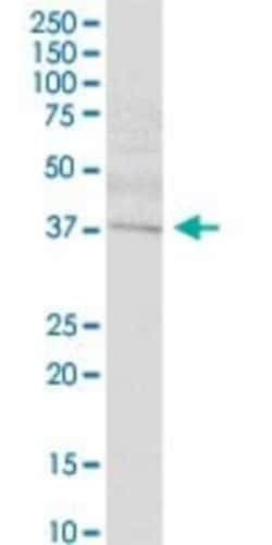 SETMAR Antibody, Novus Biologicals 0.05 mg | Buy Online | Novus Biologicals | Fisher Scientific