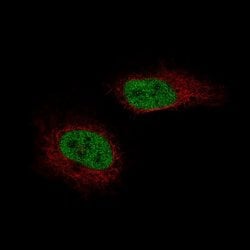 SF-1/NR5A1/Steroidogenic Factor 1 Antibody (CL9101), Novus Biologicals