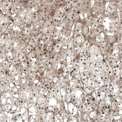 SF-1/NR5A1/Steroidogenic Factor 1 Antibody (CL9101), Novus Biologicals
