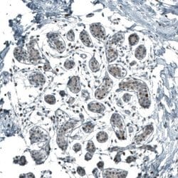 SF-1/NR5A1/Steroidogenic Factor 1 Antibody (CL9101), Novus Biologicals