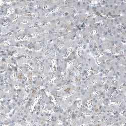 SF-1/NR5A1/Steroidogenic Factor 1 Antibody (CL9101), Novus Biologicals