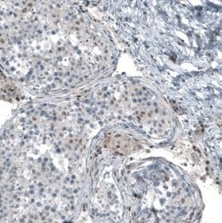 SF-1/NR5A1/Steroidogenic Factor 1 Antibody (CL9101), Novus Biologicals