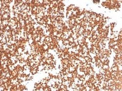 SF-1/NR5A1/Steroidogenic Factor 1 Antibody (NR5A1/3397) - Azide and BSA Free, Novus Biologicals 100 &mu;g | Buy Online | Novus Biologicals | Fisher Scientific