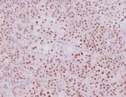 SF-1/NR5A1/Steroidogenic Factor 1 Rabbit anti-Human, Rat, Clone: NR5A1/4368R,