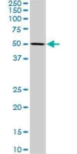 SF3A2 Antibody (3B6), Novus Biologicals 0.1 mg | Buy Online | Novus Biologicals | Fisher Scientific