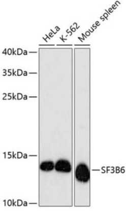 SF3B14 Antibody - Azide and BSA Free, Novus Biologicals:Antibodies:Primary