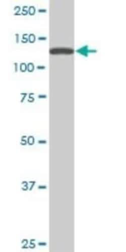 SF3B2 Antibody (5D2), Novus Biologicals 0.1 mg | Buy Online | Novus Biologicals | Fisher Scientific