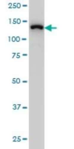 SF3B2 Antibody (5D2), Novus Biologicals 0.1 mg | Buy Online | Novus Biologicals | Fisher Scientific