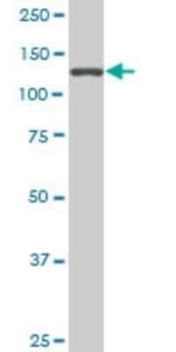 SF3B2 Antibody (5D2), Novus Biologicals 0.1 mg | Buy Online | Novus Biologicals | Fisher Scientific