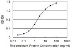 SF3B4 Antibody (1B8), Novus Biologicals 0.1 mg | Buy Online | Novus Biologicals | Fisher Scientific