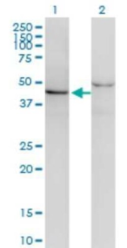 SF3B4 Antibody (1B8), Novus Biologicals 0.1 mg | Buy Online | Novus Biologicals | Fisher Scientific