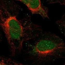 SFMBT2 Rabbit anti-Human, Polyclonal, Novus Biologicals:Antibodies:Primary