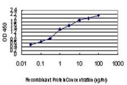 SFPQ Antibody (6D7), Novus Biologicals 0.1 mg | Buy Online | Novus Biologicals | Fisher Scientific