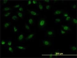 SFPQ Antibody (6D7), Novus Biologicals 0.1 mg | Buy Online | Novus Biologicals | Fisher Scientific