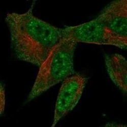 SFRS18 Rabbit anti-Human, Polyclonal, Novus Biologicals 100 &mu;g; Unconjugated:Antibodies,