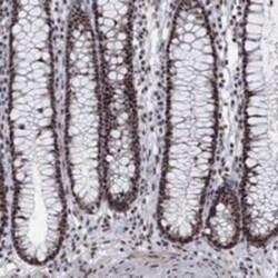 SFRS18 Rabbit anti-Human, Polyclonal, Novus Biologicals 100 &mu;g; Unconjugated:Antibodies,