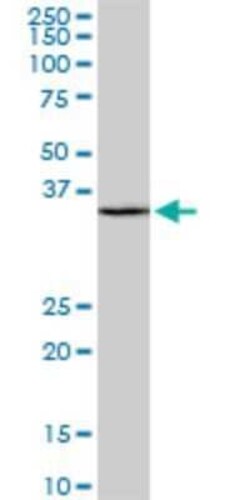 SFRS9 Antibody (1G7), Novus Biologicals 0.1 mg | Buy Online | Novus Biologicals | Fisher Scientific