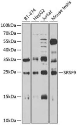 SFRS9 Antibody - BSA Free, Novus Biologicals 0.02 mL; Unconjugated:Antibodies,